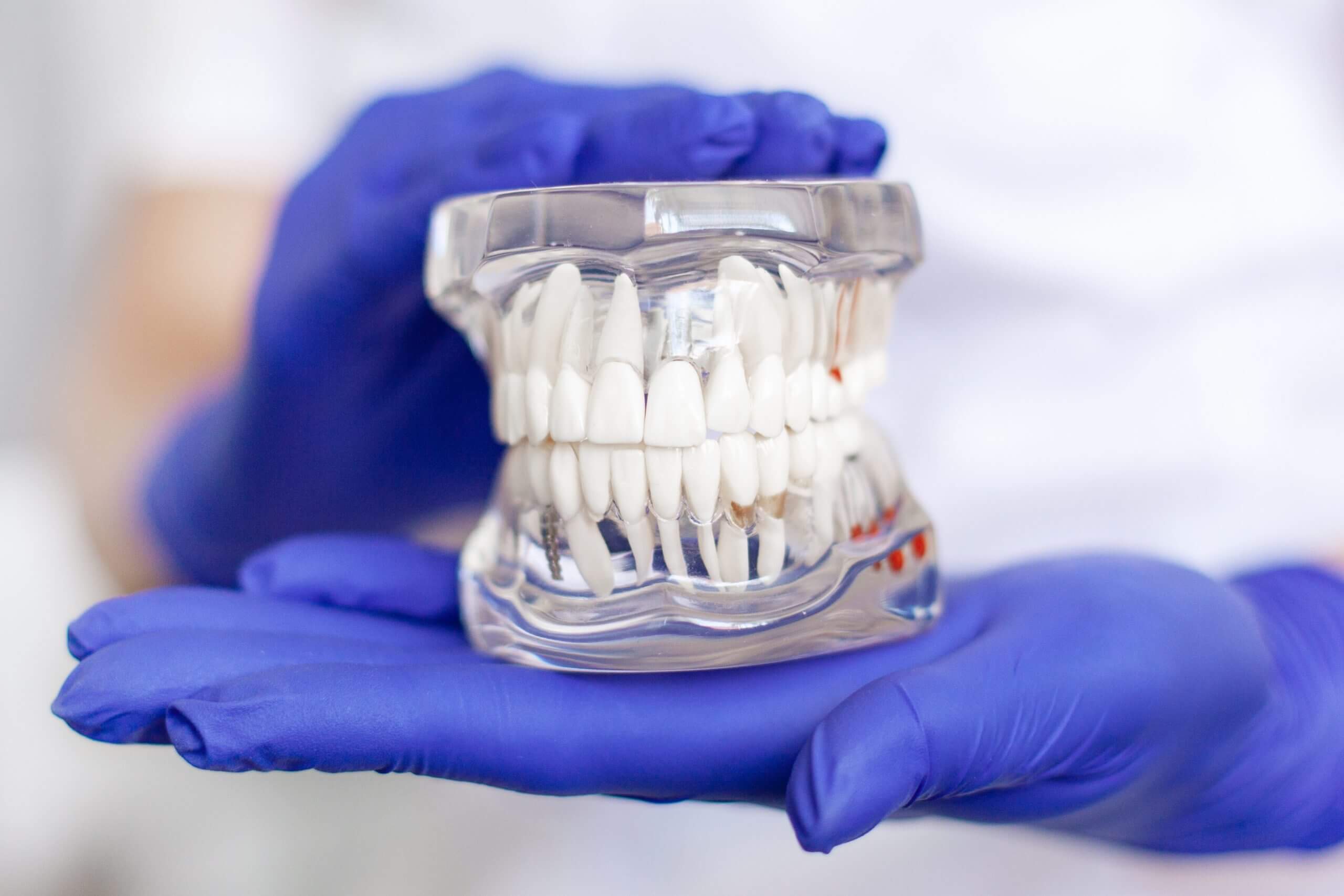 teeth-in-a-day options