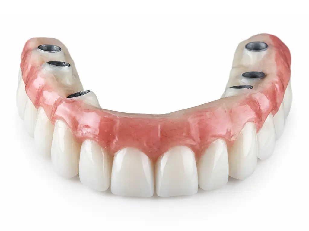 Replace a Full Mouth
